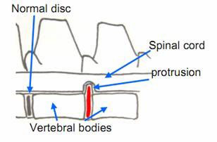Cervical figure 3