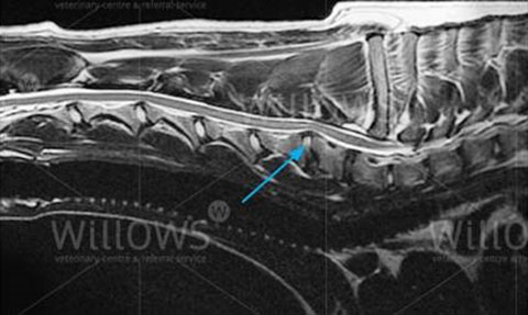 Cervical figure 4