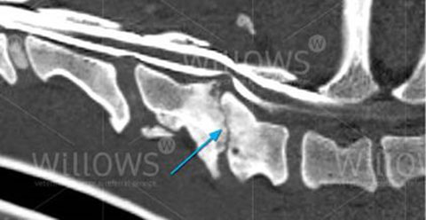 Cervical Vertebral Malformation figure 3