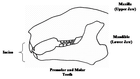 Dental Malocclusion figure 1