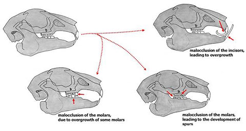 Dental Malocclusion figure 2