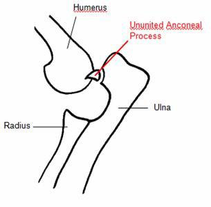 Elbow Dysplasia figure 3