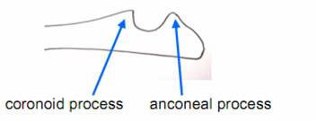 Elbow Dysplasia (FMCP) figure 2