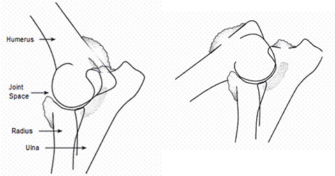 Elbow Dysplasia (FMCP) figure 6