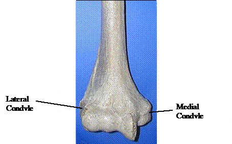 Elbow Dysplasia figure 2