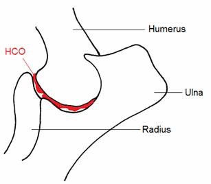 Elbow Dysplasia figure 3