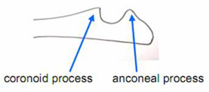 Elbow figure 2