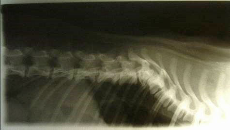 Hemivertebrae figure 4