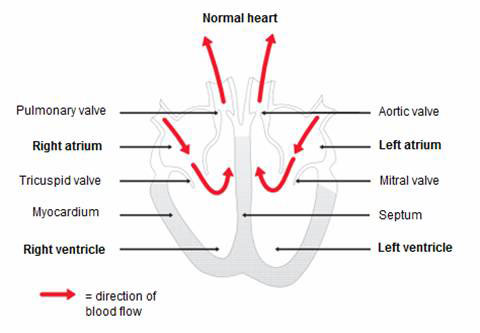 Hypertrophic Cardiomyopathy figure 1