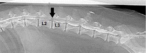 Intervertebral Disc Disease figure 4