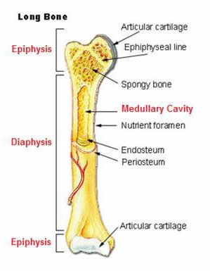 Osteosarcoma figure 1