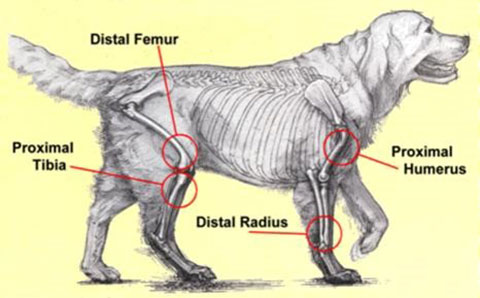 Osteosarcoma figure 2