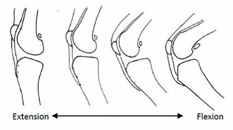 Patellar Figure 3