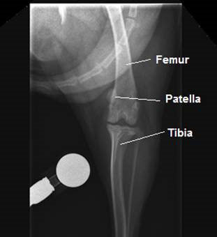Patellar Figure 5
